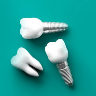 Types Of Dental Implants And Their Benefits