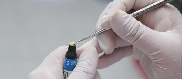 Complete Guide to Dental Composite Reconstruction for Dentists