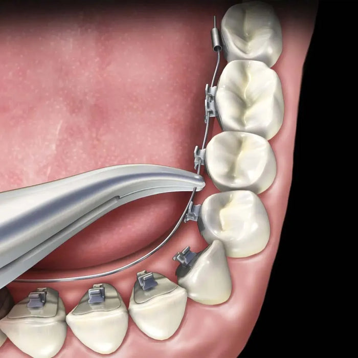 Topdent Seperating Pliers