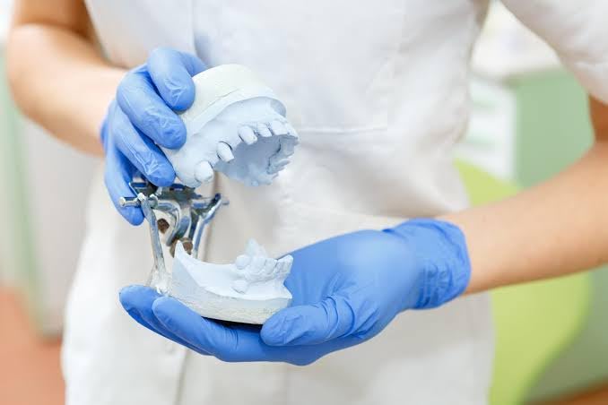 Dentrock Die Stone Type IV - 1KG