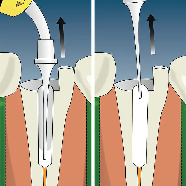 Kids-e-Dental E-IodoCal