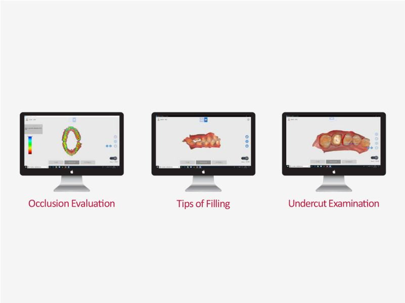 Agkem 3d intraoral scanner