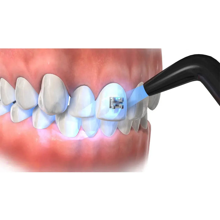 Prevest Denpro Fusion Crysta Adhesive Primer