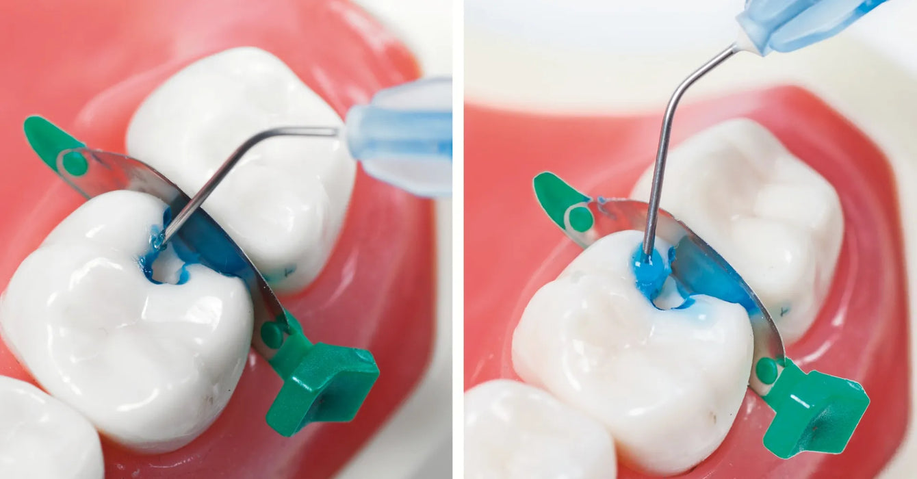 Vishal Dentocare V - ETCH - AB