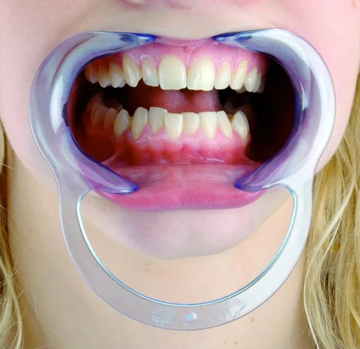 Cotisen Cheek Retractor