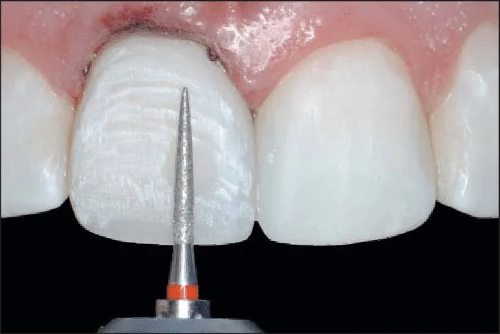 Mani Diamond Burs Cr-Polishing Series