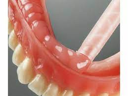 medicept reviver silicon denture relinng material