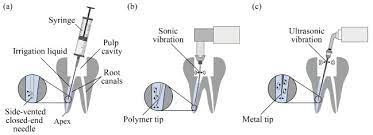 vishal dentocare cmcp root canal irrigant