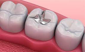 vishal dentocare mercury