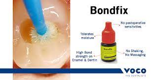 voco bondfix – bottle 2ml self-etch bond
