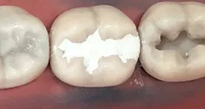 D-Tech Iono-Set Universal Liquid