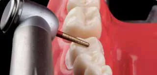 Appledental Standard head push button Hand Piece model (SU)