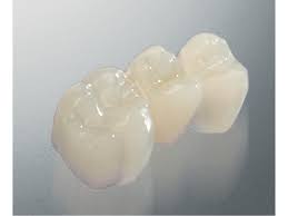 detax dental tempofit premium 10/1