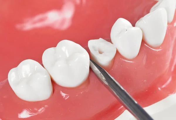 LUXATOME Set of 9 (Plastic Handle)