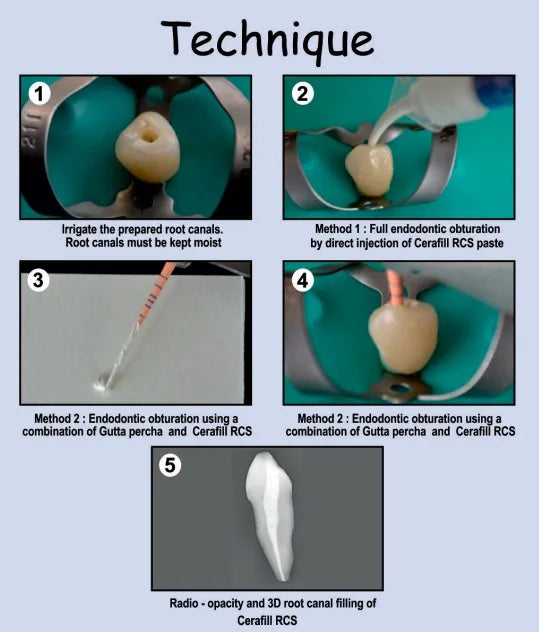 Prevest Cerafill Rcs - 1 x2 gm