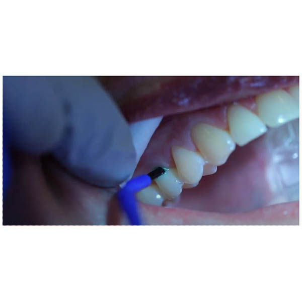 gc dentin conditioner