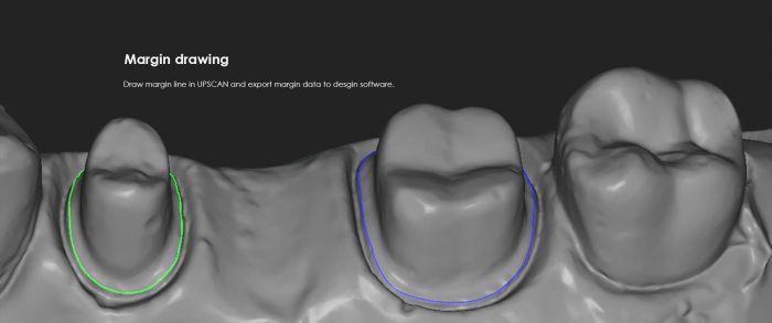 Up3d UP360 3D Dental Laboratory Scanner - [dental_express]