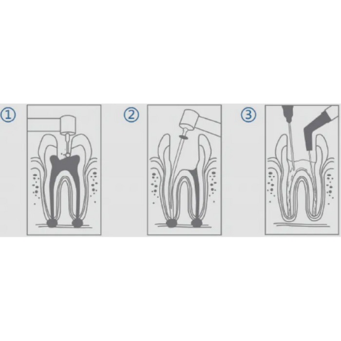 cotisen endodontic aspirator tip (20pcs)