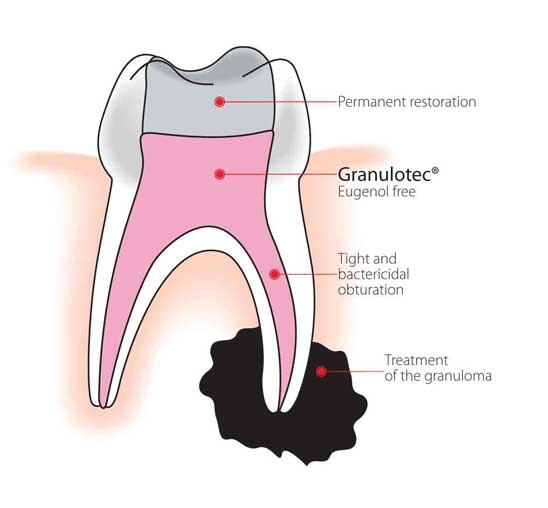 pd granulotec (20 gm powder + 15 ml liquid)