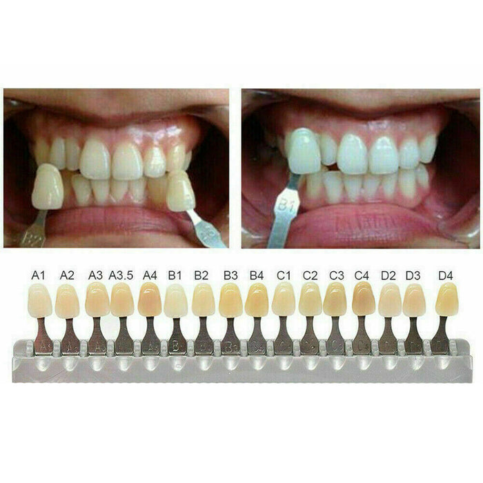 Tooth Color Chart B1 Aesthetic Update The Art Of Clinical Shade